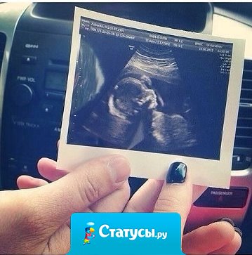 Вот такой должен быть итог каждой любви, а не так — пожили и разбежались...