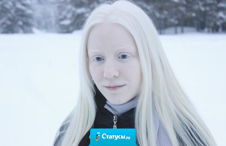 Простой блондинкой конечно тяжело быть…что ж  тогда творится в жизни у альбиносок?